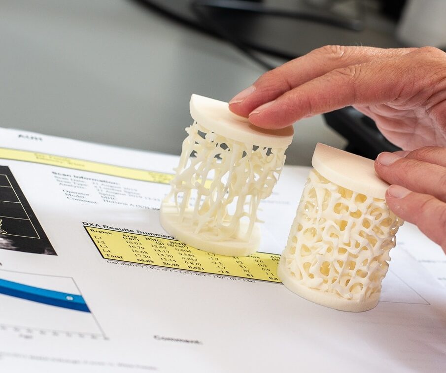 Billede af knoglestruktur