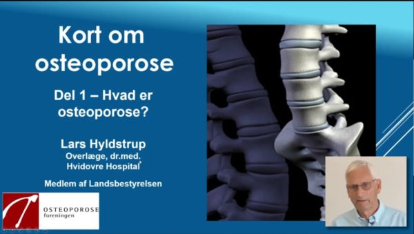 Kort om osteoporose - del 1